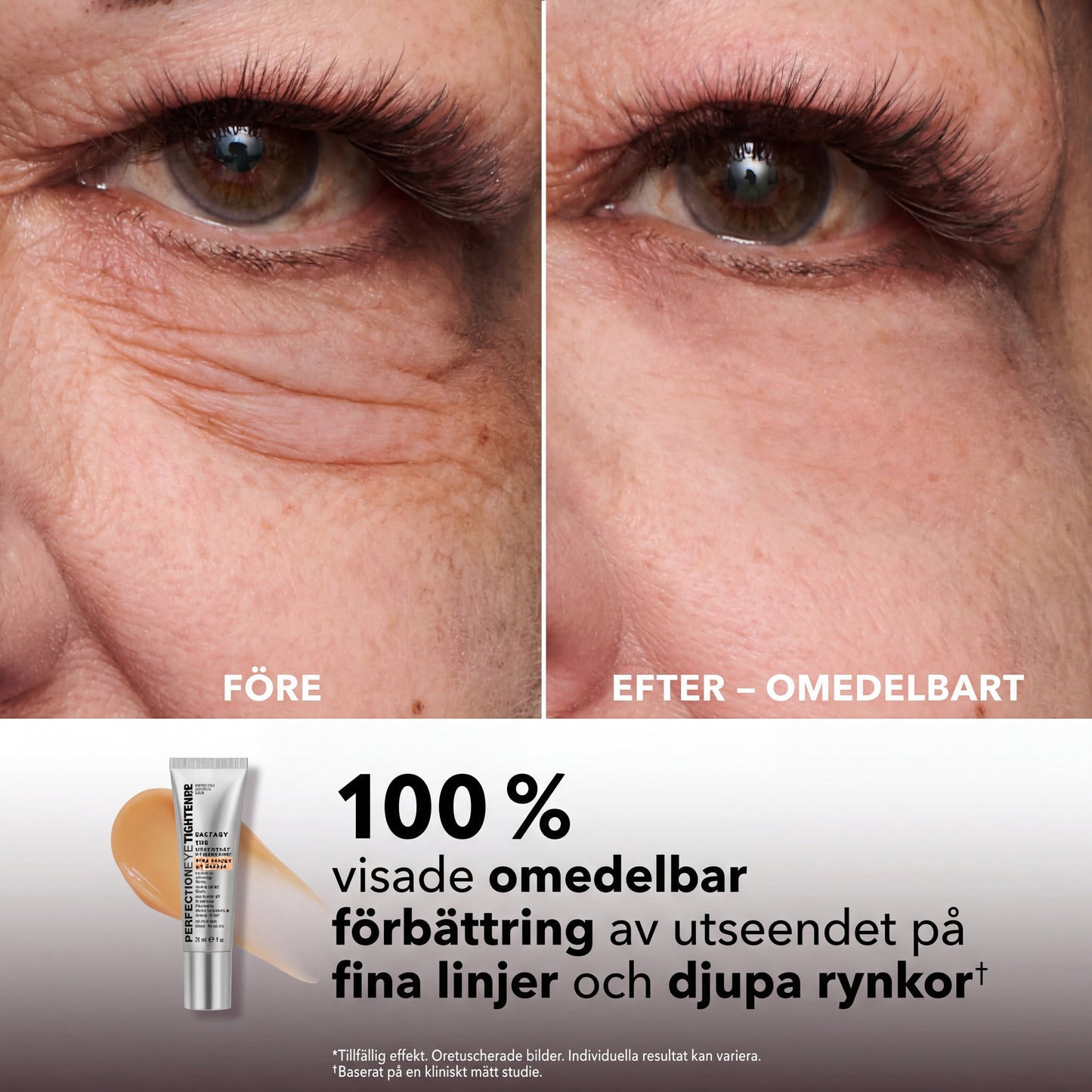 BrighSkin™ Instant Eye Tightener