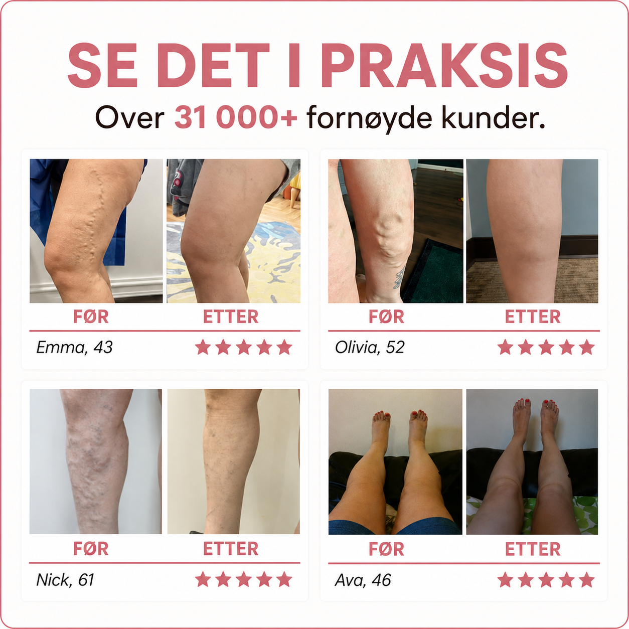Brightskin Benro - En lettere følelse etter lange dager.
