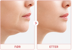 Brightskin PoreReset™ - behandling for hudormer og synlige porer