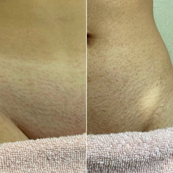 brightskin testimonial petra