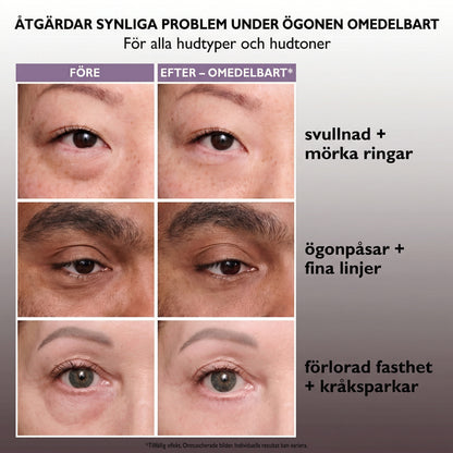 BrighSkin™ Instant Eye Tightener